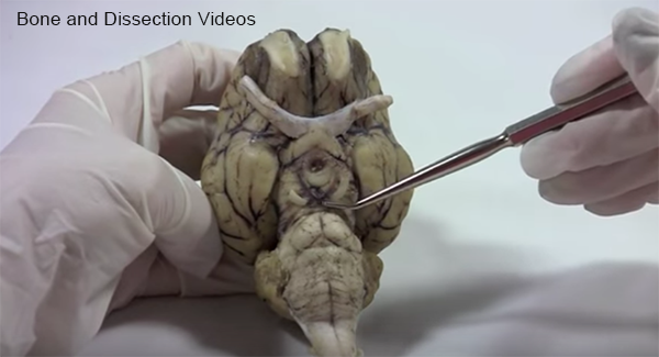 Brain and Dissection Videos